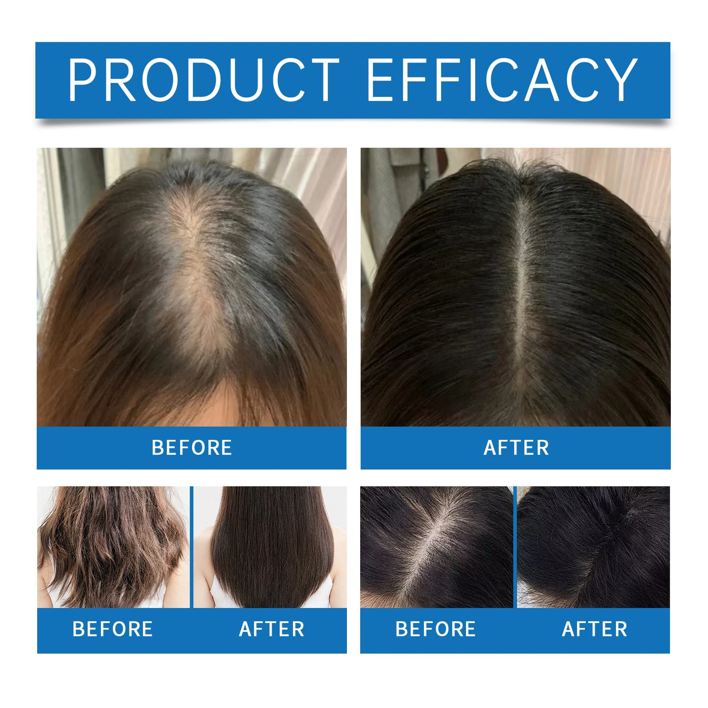 Rosemary Hair Growth Serum Roll-On | Nourishing Scalp & Stronger Hair